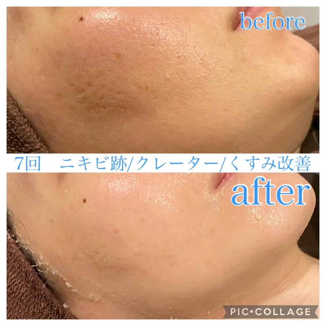 セミロング カラー パーマ ヘアアレンジ メンズ ネイル マツエク・マツパ エステ リラク EnsorClair 代表 野口真央のエステ・リラクイメージ