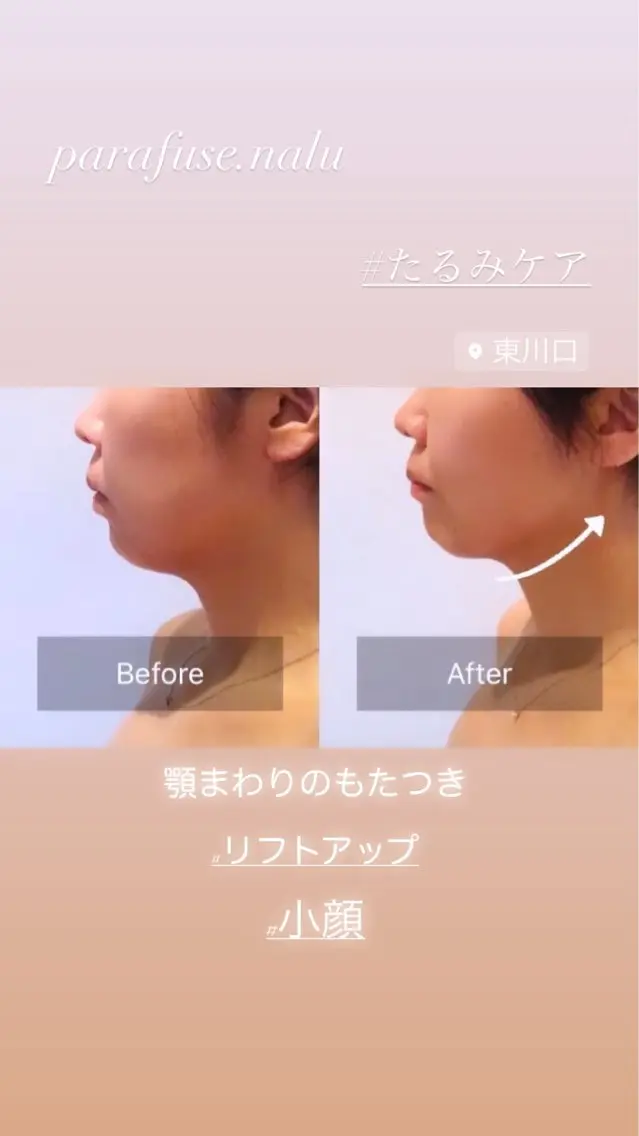 たるみケアフェイシャル&ヘッドを体験していただきお写真撮影にご協力いただける方‼︎特別価格でのご案内となります✨の写真