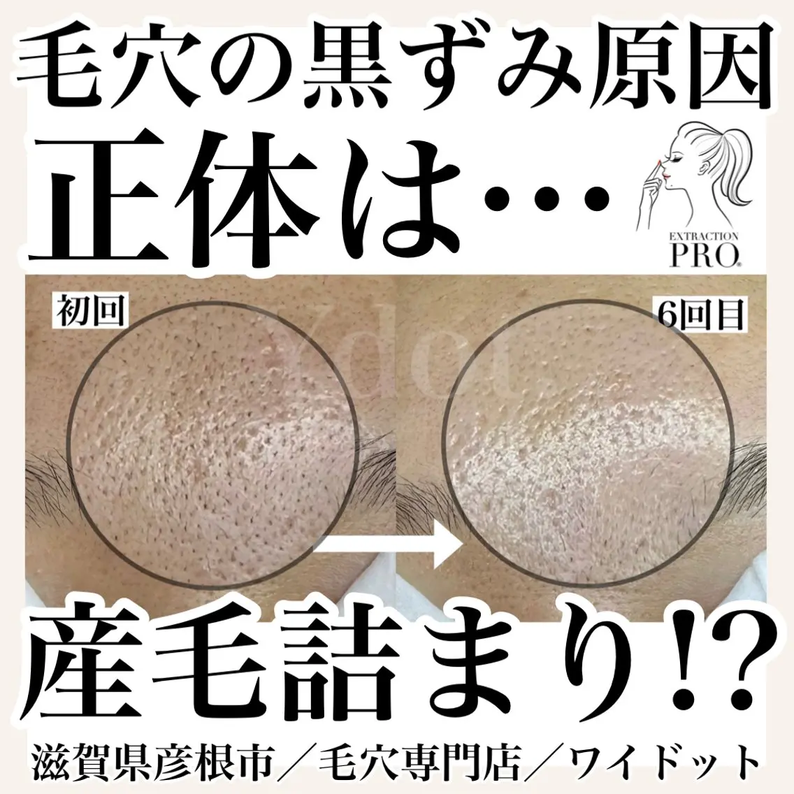 エステ Ydot. 池内 友架のエステ・リラクイメージ