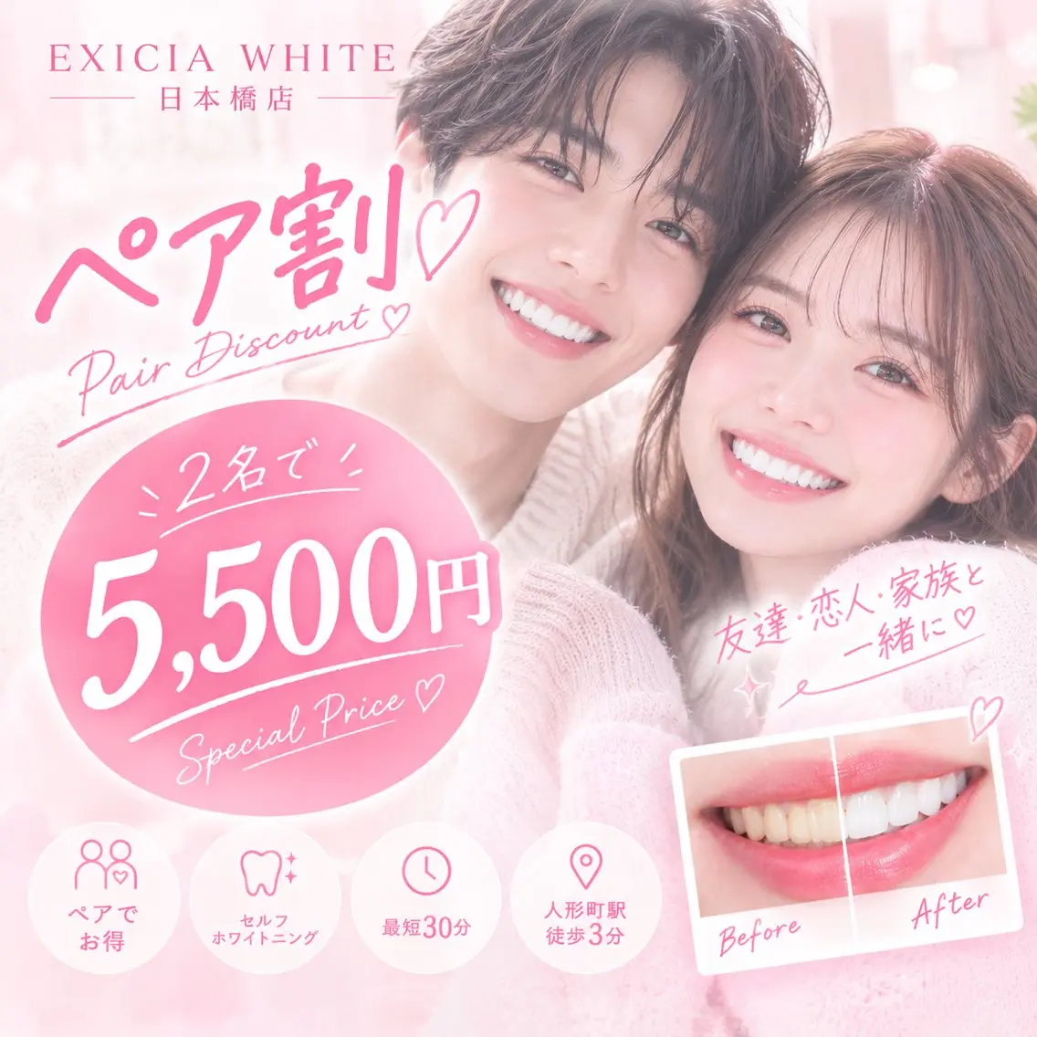 【ペア割】¥17600→¥5,500★カップルやご夫婦!お友達や同僚と一緒にホワイトニング★の写真