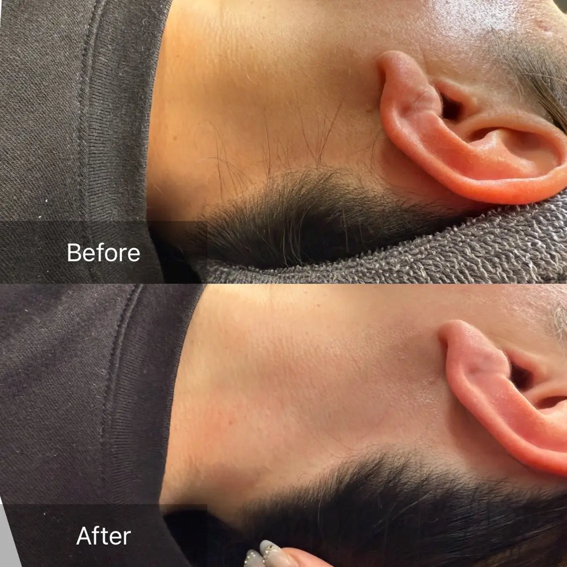 【追加オプション】うなじwaxの写真