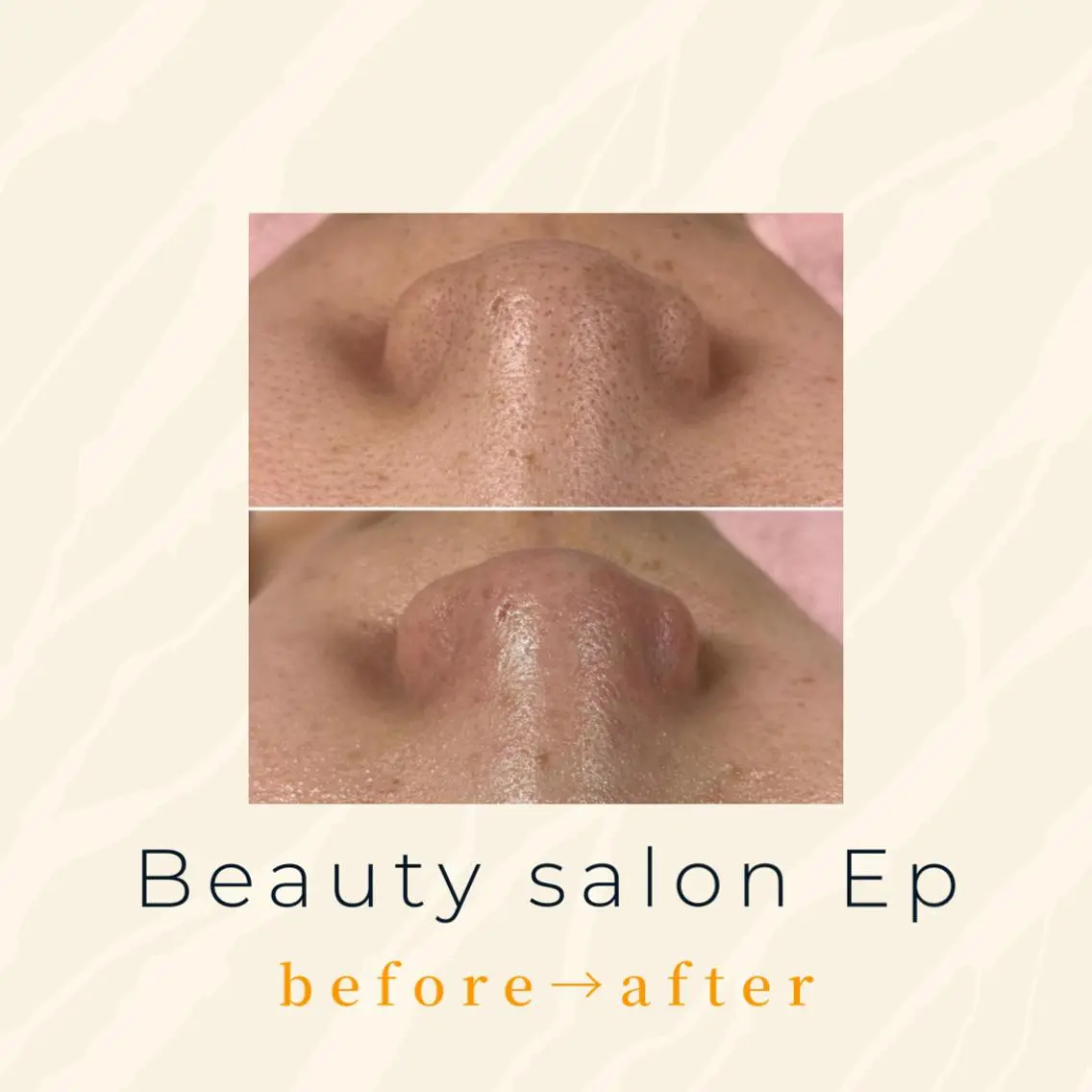 メンズ beauty salon epのエステ・リラクイメージ