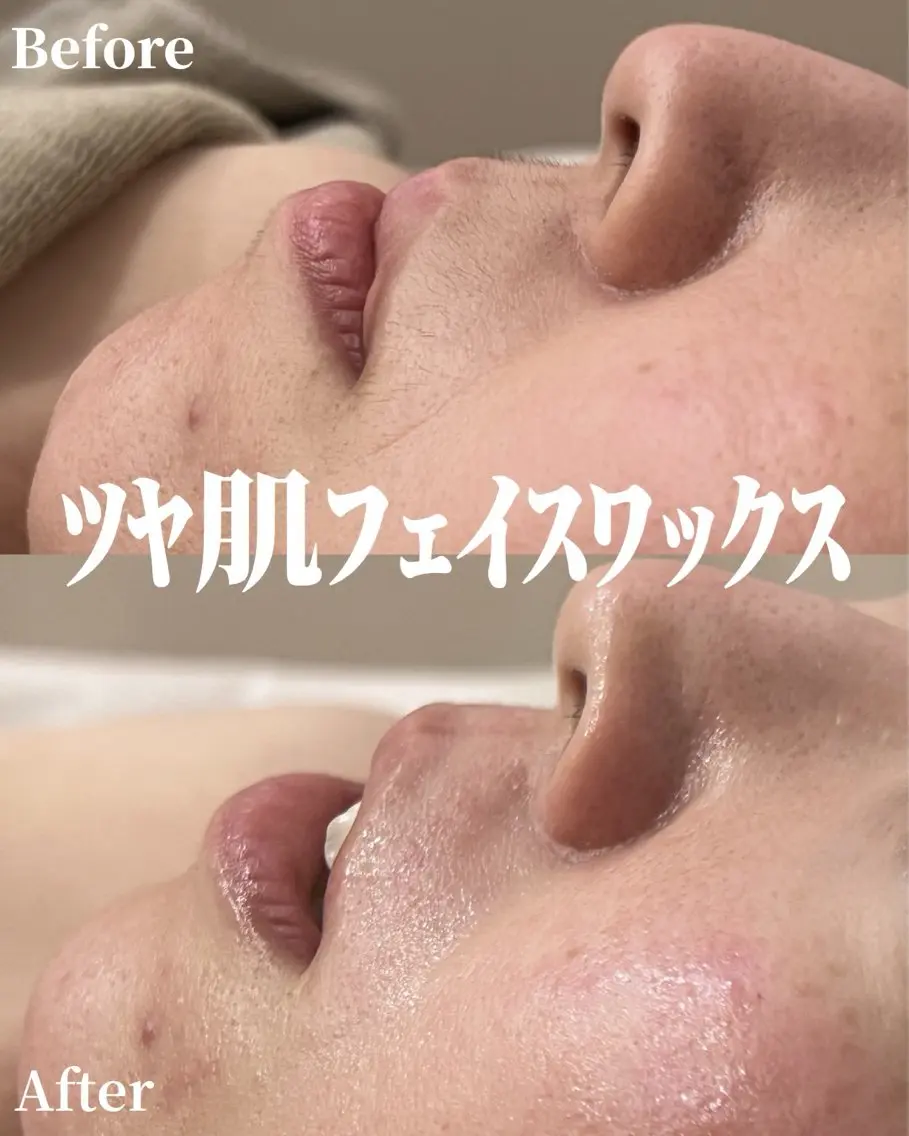 Maison Ulyssesのエステ・リラクイメージ