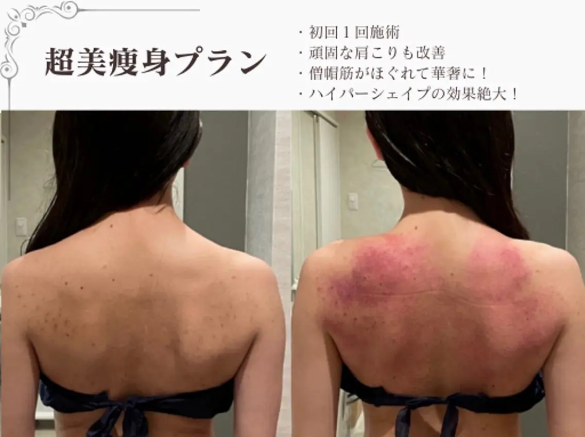エステ リラク 総合美容サロン LOVEME渋谷本店のエステ・リラクイメージ