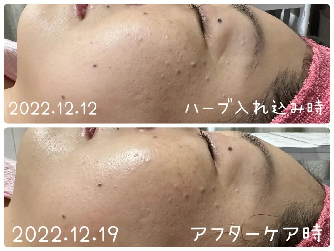 デトックス専門サロン ココシュエットのエステ・リラクイメージ