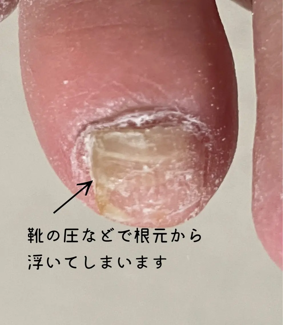 メンズ ネイル フットネイル ジェルネイル Chérinail 爪のお手入れのネイルデザイン