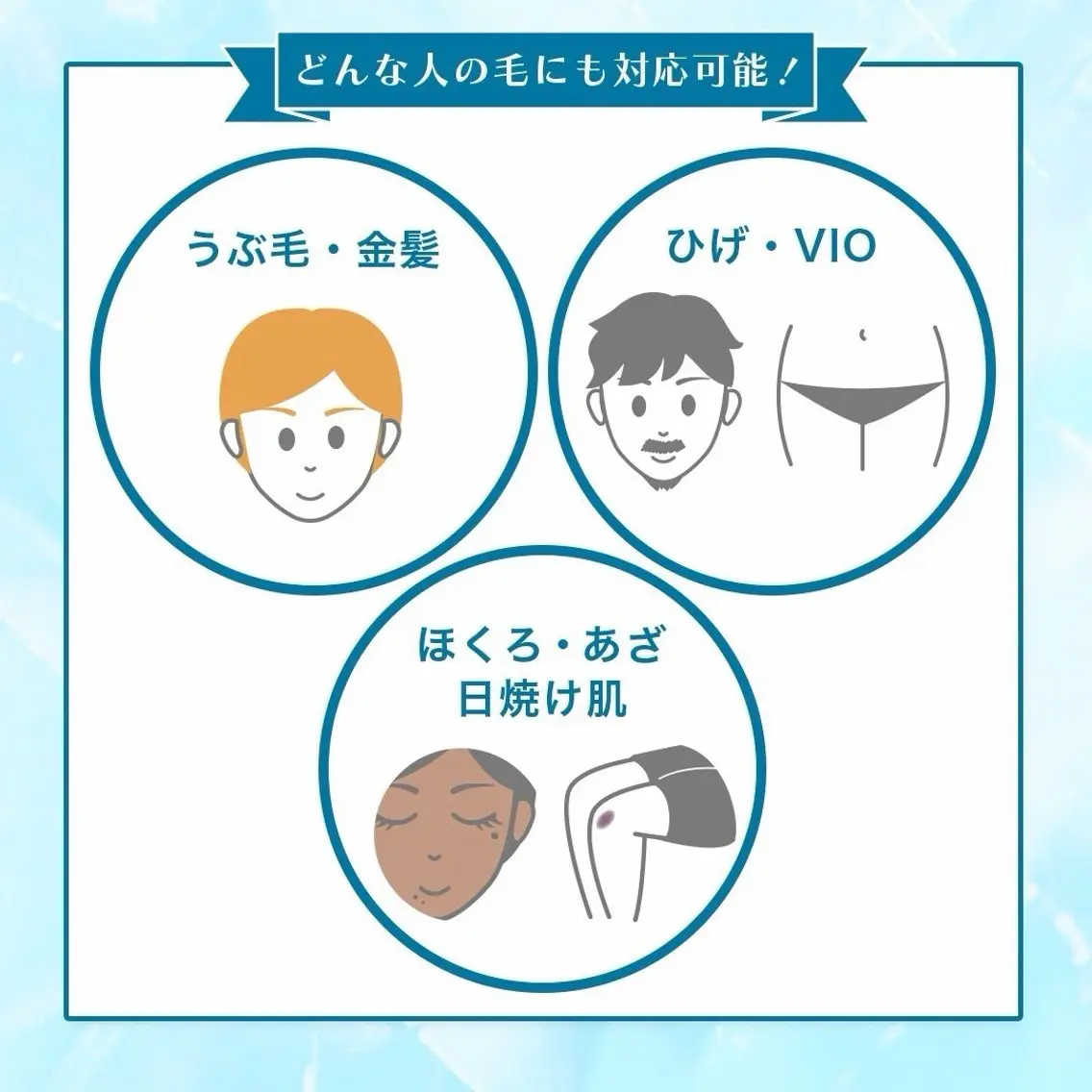 脱毛 グリーニャ セルフエステのその他イメージ