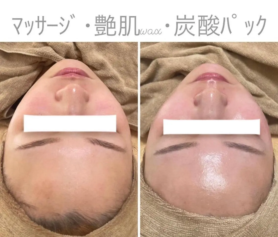 脱毛 エステサロン Mi-mi.iのエステ・リラクイメージ