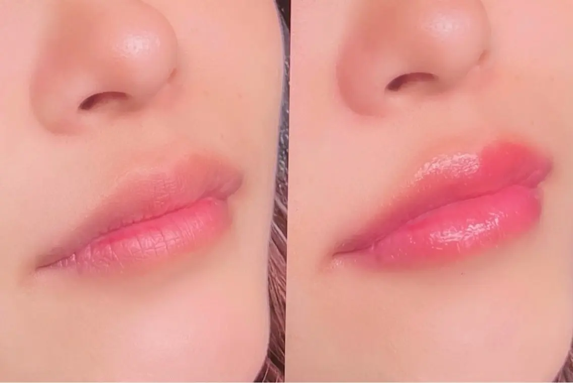 メラニンケア⭐️LALA PINKモニター(リップ)の写真