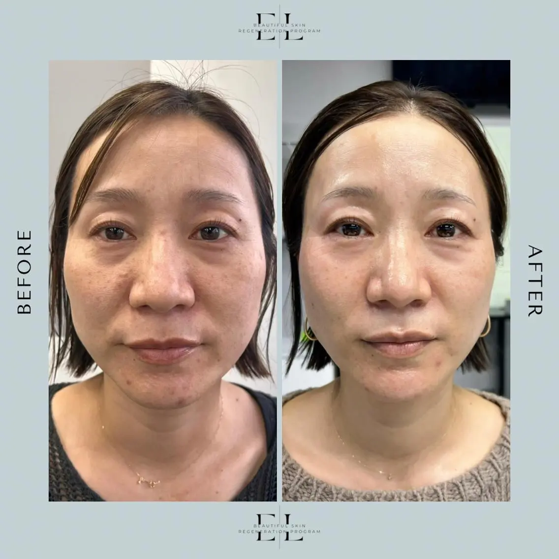 White labo 須谷のエステ・リラクイメージ