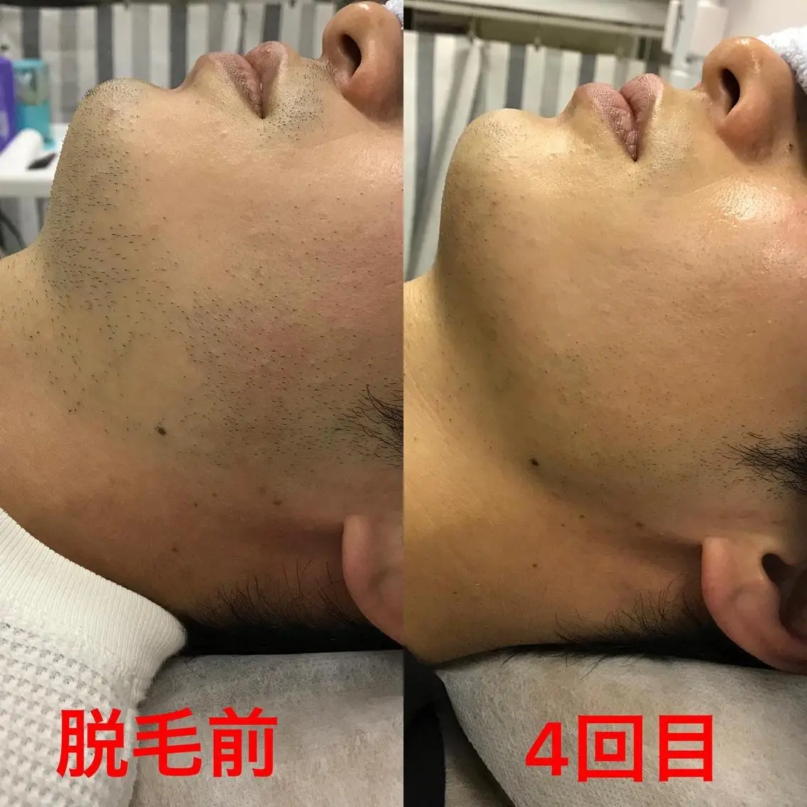 メンズ 脱毛 メンズ脱毛サロン ／金山昌弘のエステ・リラクイメージ