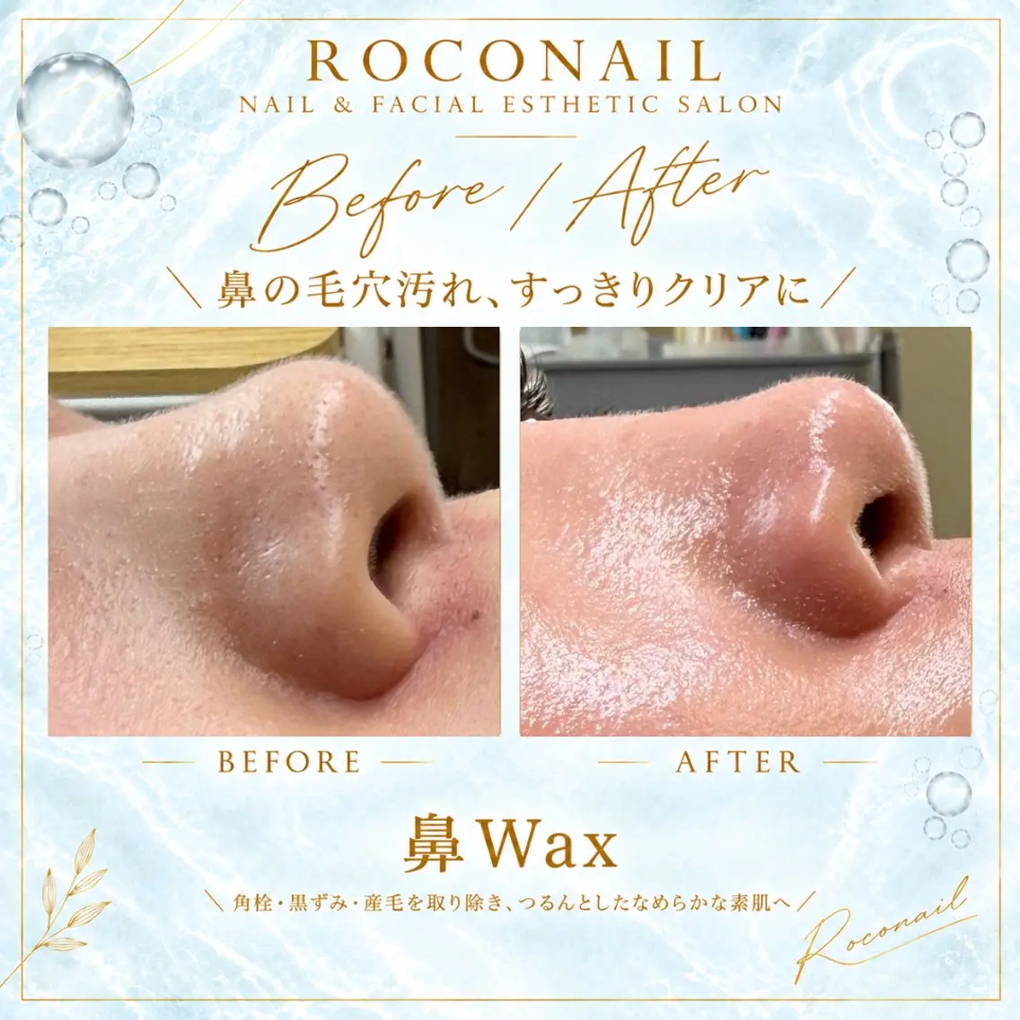 脱毛 roconail& WAX|ヒロコ鎌ヶ谷のエステ・リラクイメージ