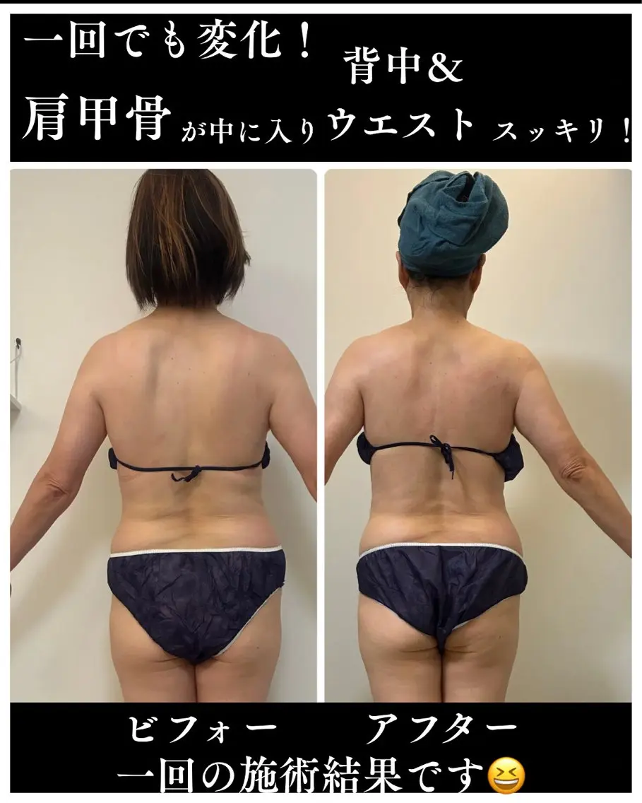 エステ オールハンド筋膜痩身 整体/小顔　中山朝美のエステ・リラクイメージ