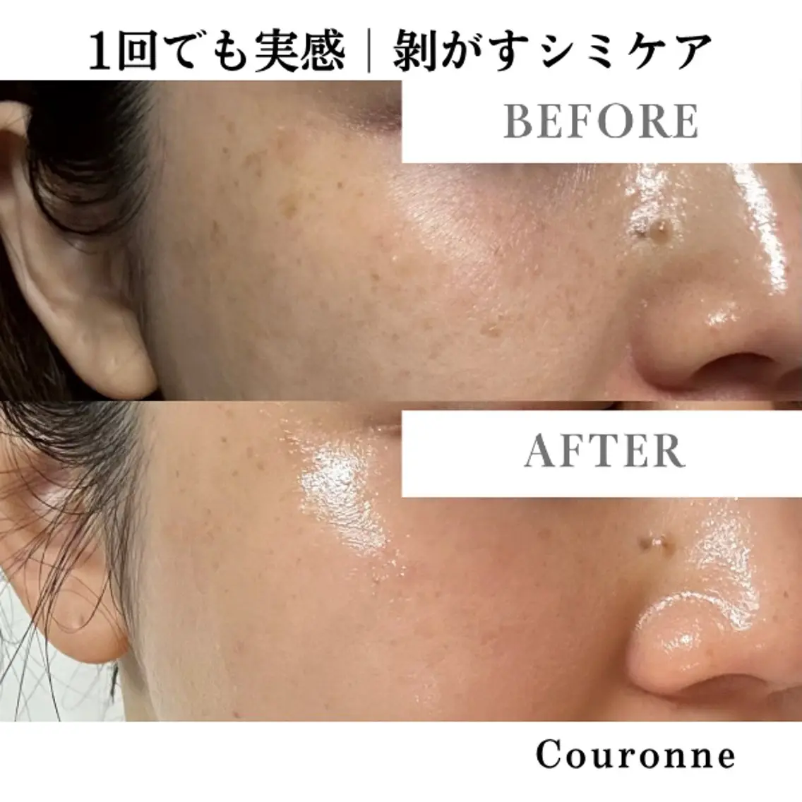 エステ シミ・毛穴ケア専門 クロヌYUKIのエステ・リラクイメージ