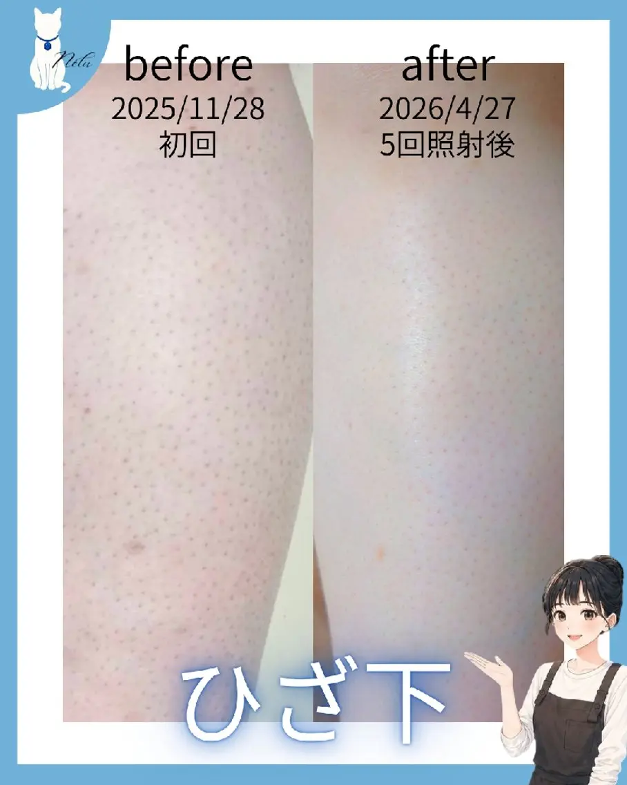 脱毛 矢口 純子のエステ・リラクイメージ