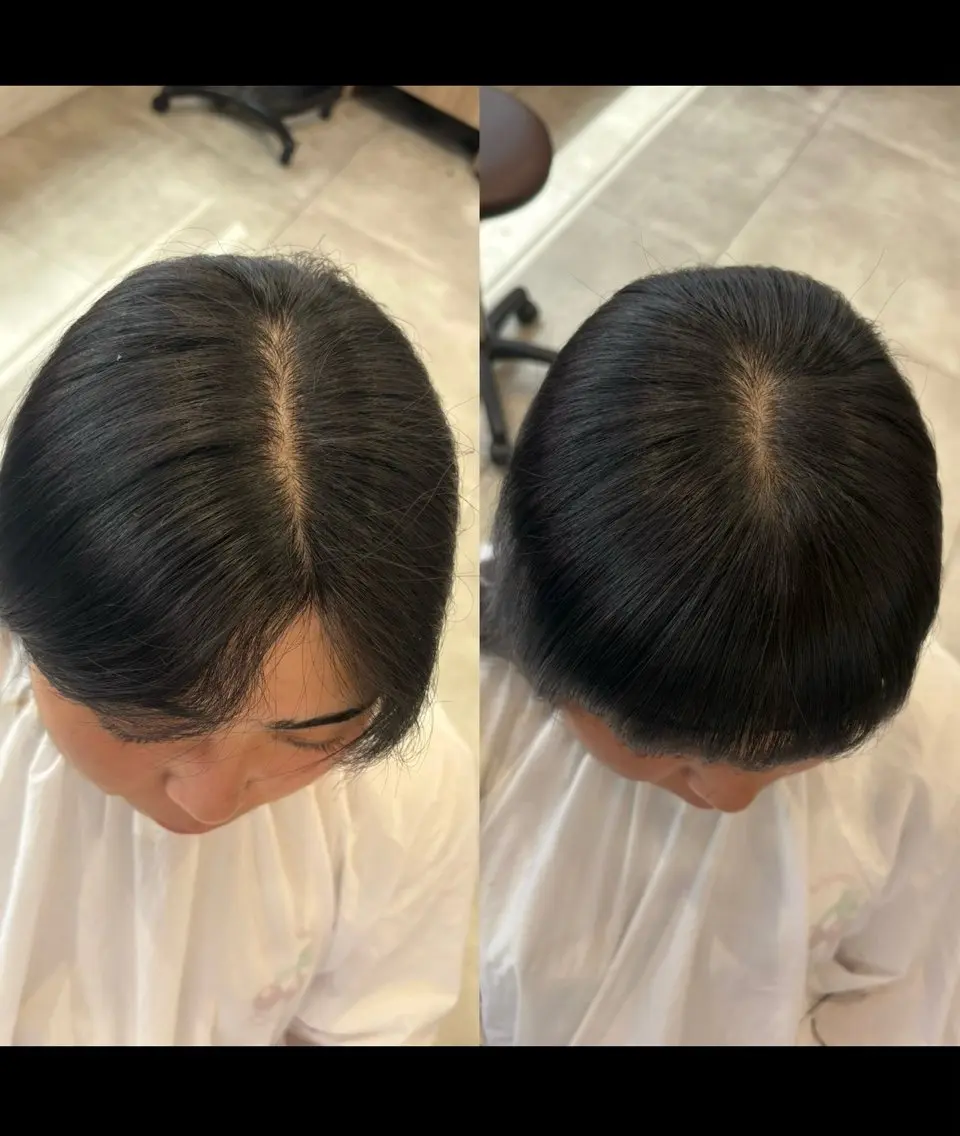 ショート ⭐️生えぐせ改善 ヘアリセッター✂️のヘアスタイル