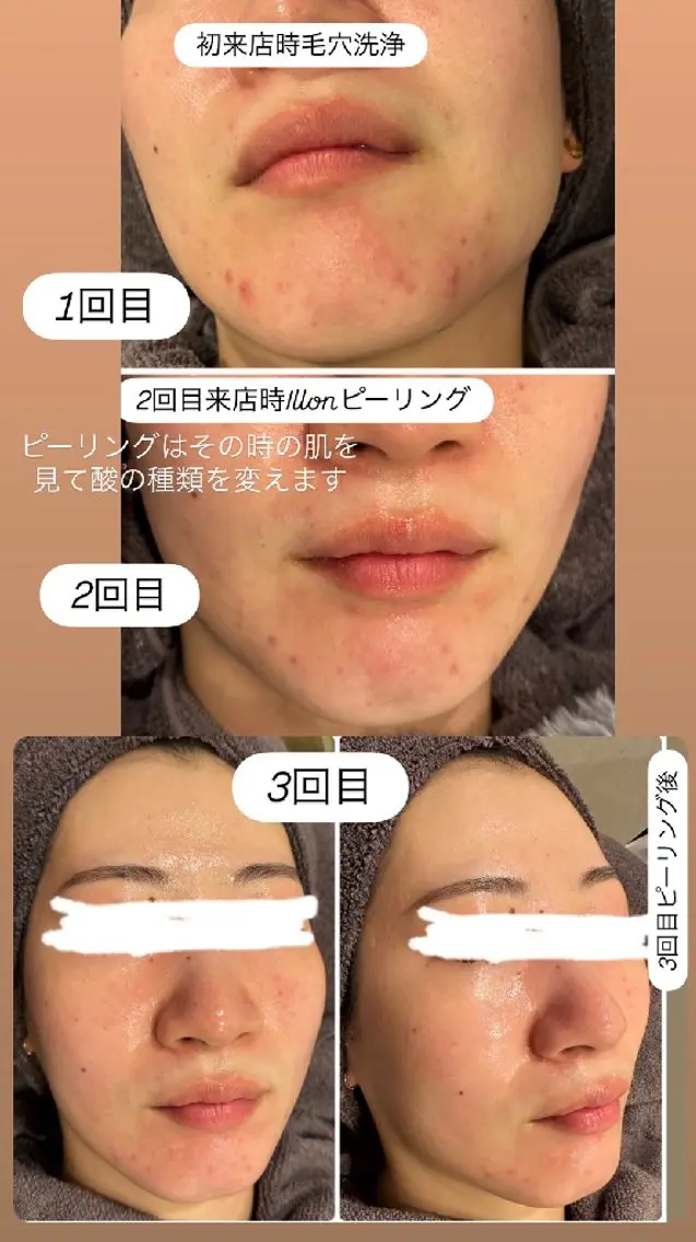 看護師　桐山 まどかのエステ・リラクイメージ