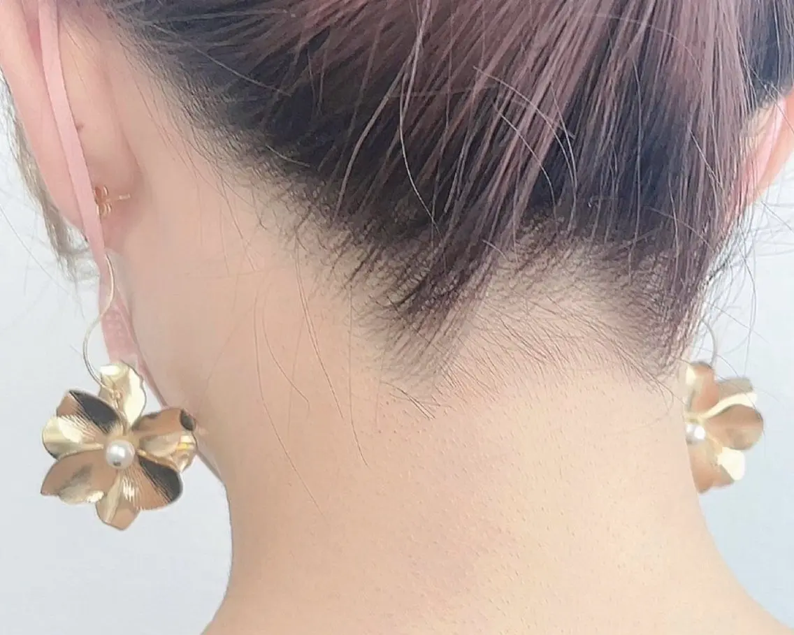 👑女性人気👑no1👩うなじ脱毛　　　　　　￥2,200⇨￥1,100の写真