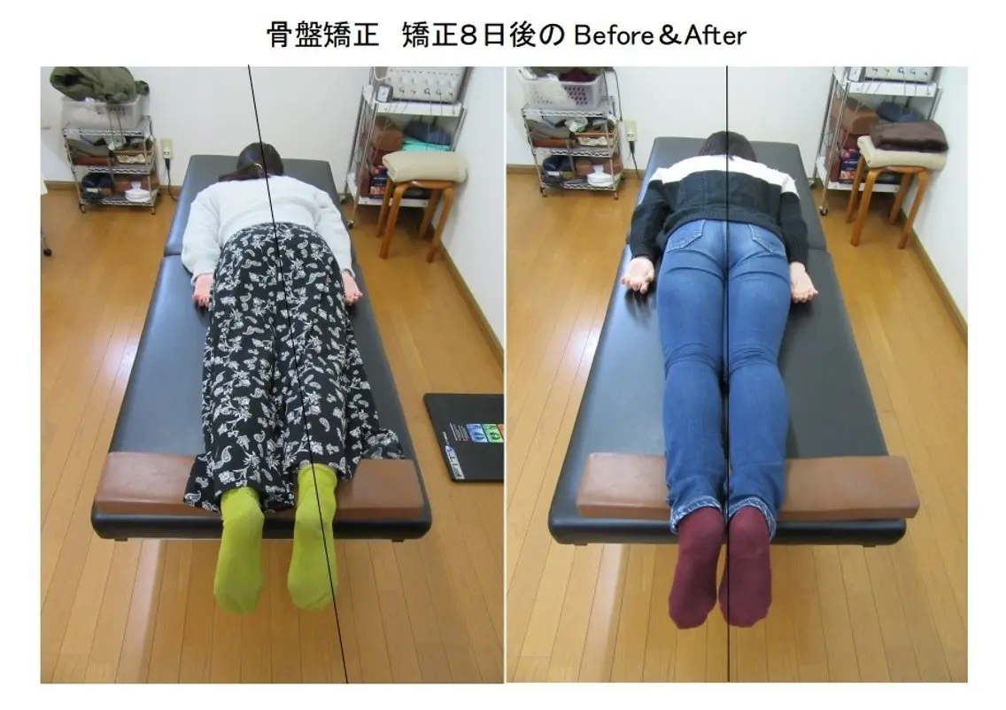 もうその場しのぎは終わり!「骨✕筋肉」を同時に整える整体の写真