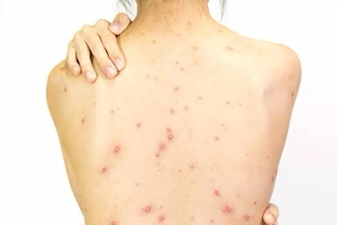 背中美肌ケア体験​〜​背中のニキビ、毛穴、肌荒れにお悩みの方へ、プロの手でスッキリ解消​〜​の写真
