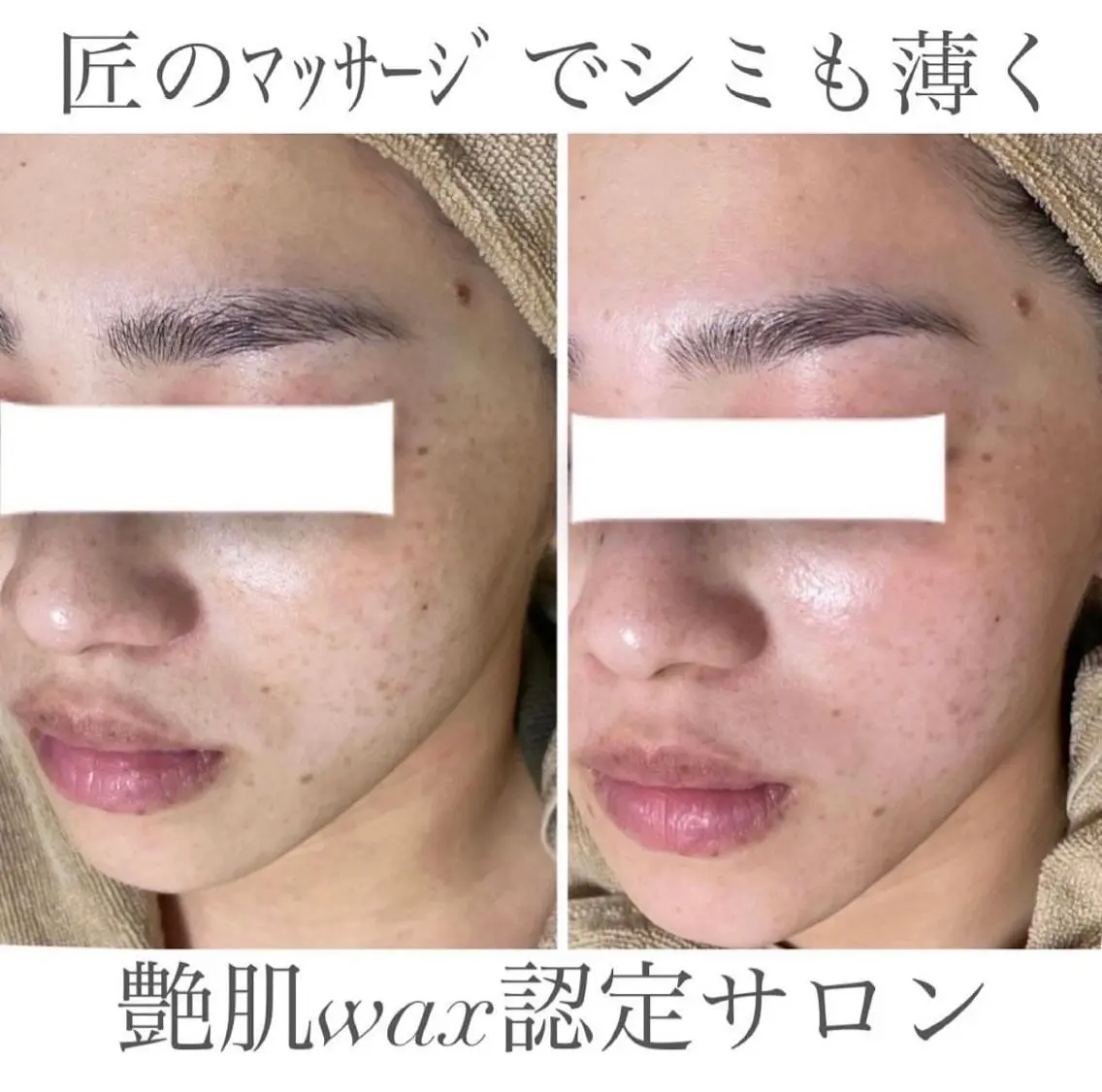 脱毛 エステサロン Mi-mi.iのエステ・リラクイメージ