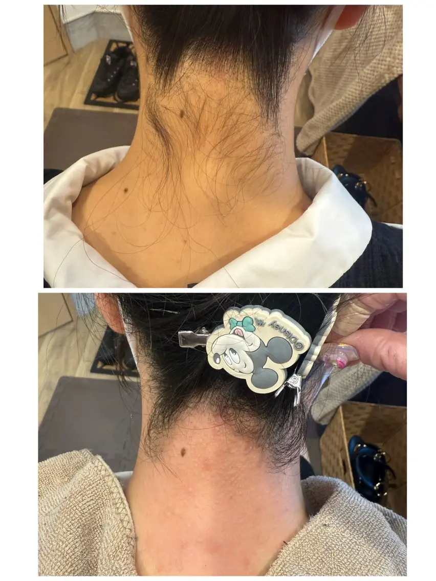 うなじワックス＆鼻毛ワックスの写真