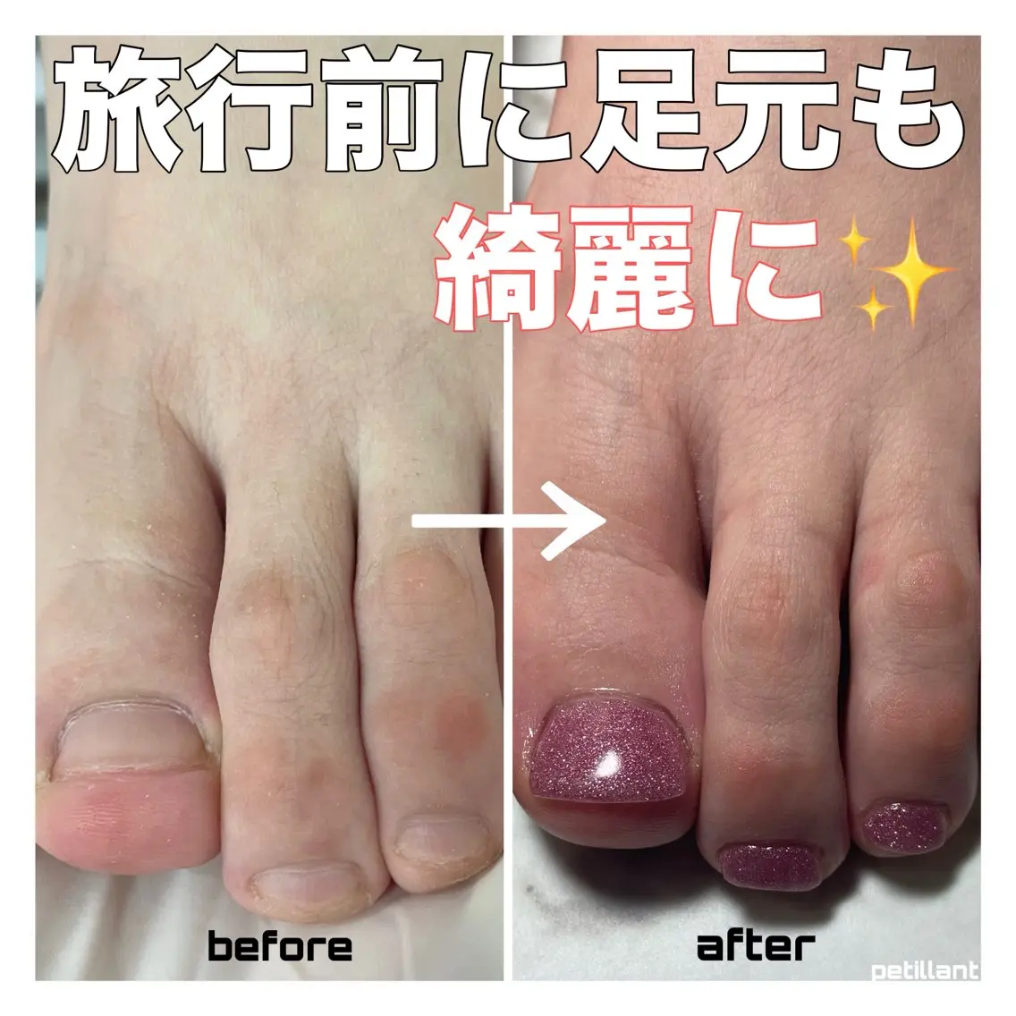 ネイル フットネイル nail salon petillantのネイルデザイン