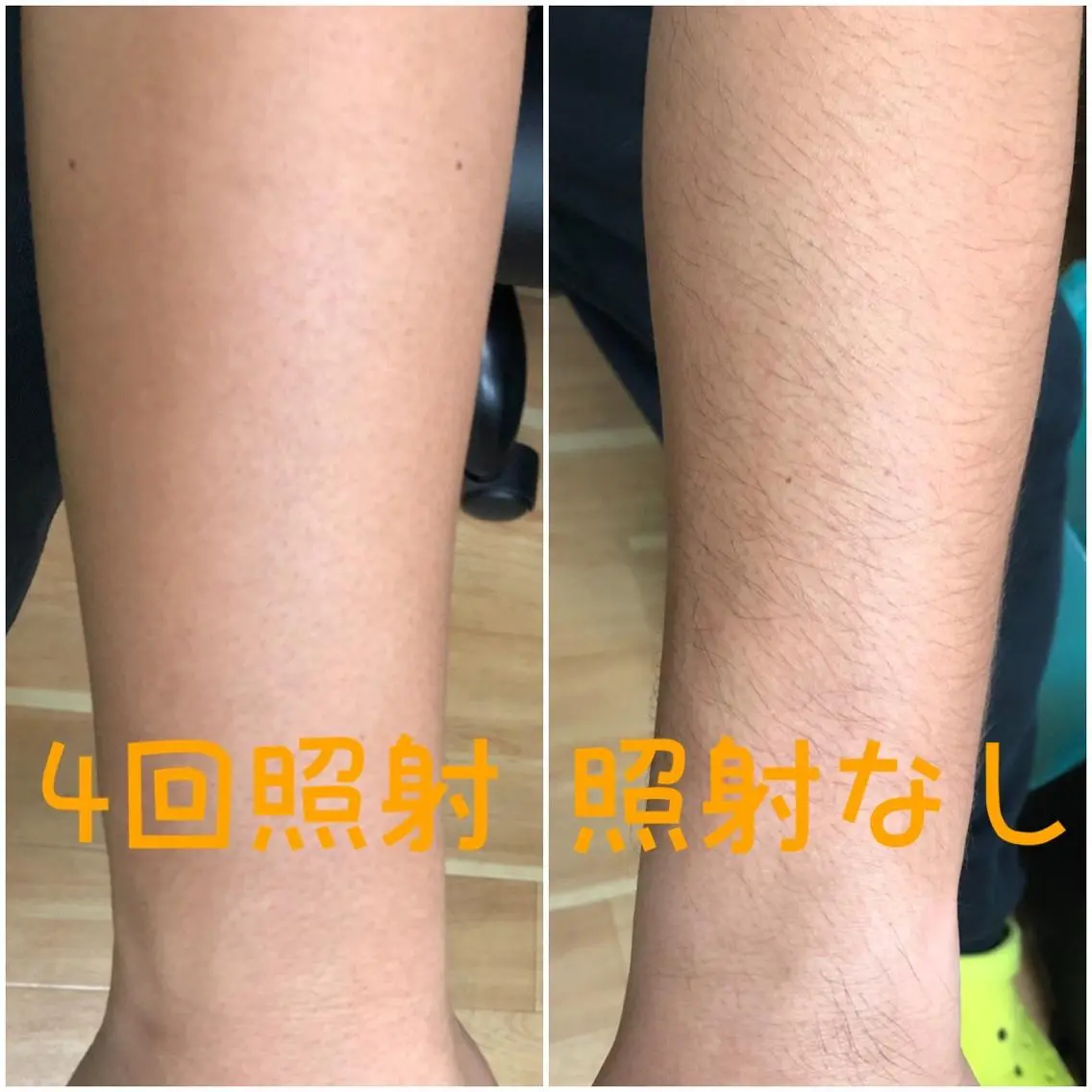 メンズ salon   de epilaのエステ・リラクイメージ