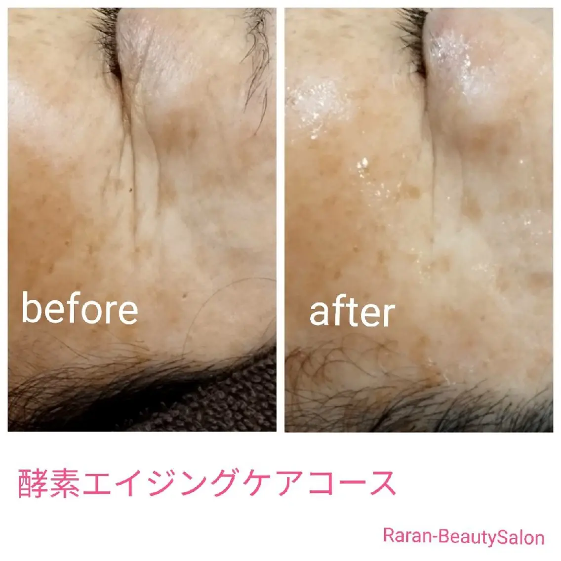 若返り 美肌   エステサロンららんのエステ・リラクイメージ