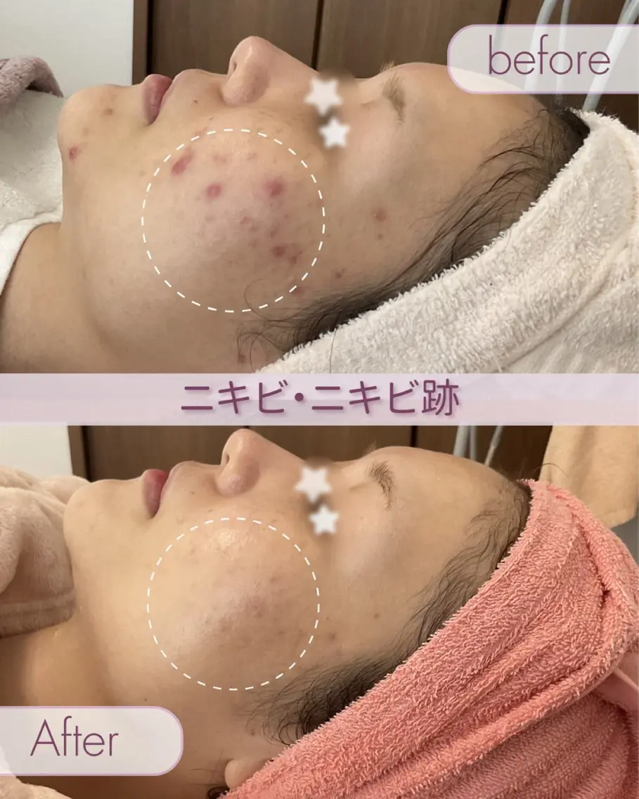 肌質改善サロン ココマヒナのエステ・リラクイメージ