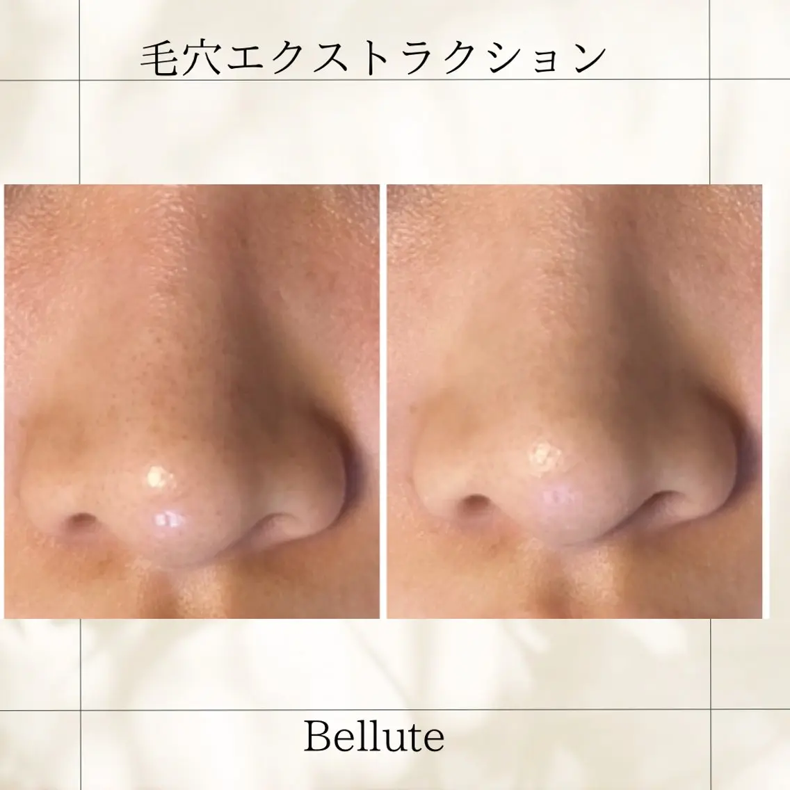 エステ リラク ピーリング専門店 Belluteのエステ・リラクイメージ