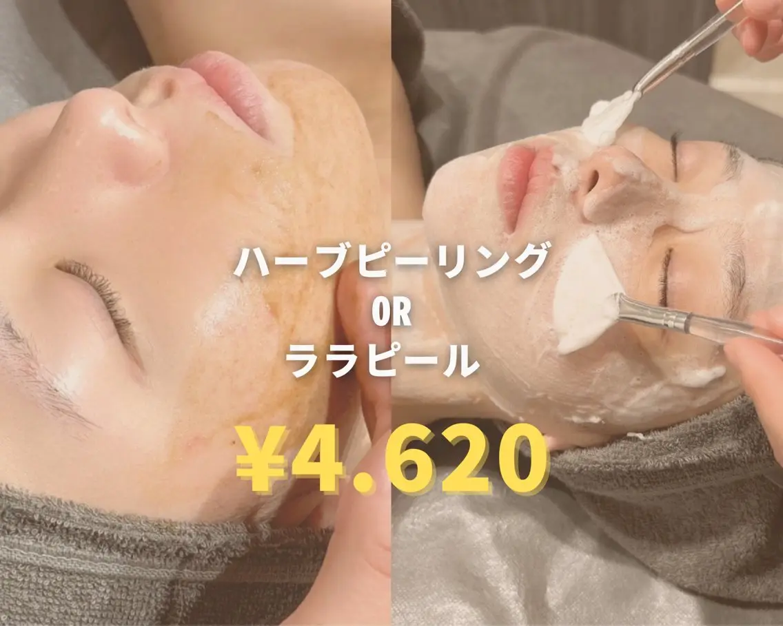 【新規様限定】⭐︎ララピール・ハーブピーリング⭐︎各種¥7.700→¥4.620の写真