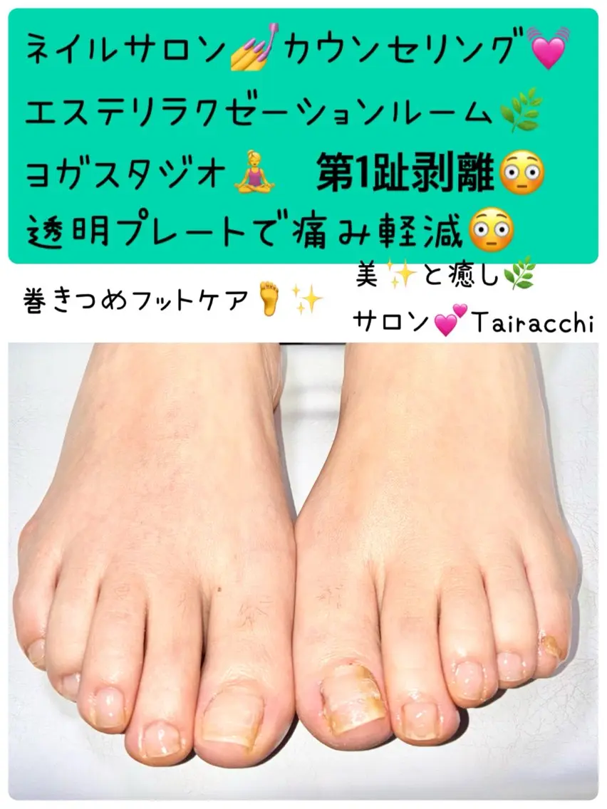 ネイル フットネイル フットネイル Tairacchi ﾀｲﾗｯﾁのネイルデザイン