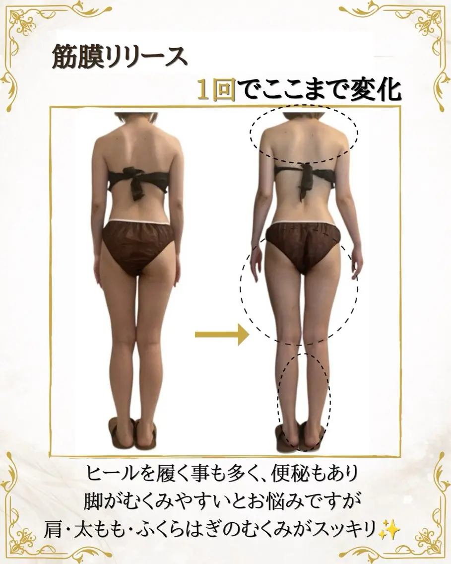 筋膜×深部温熱 リラク★痩身RIONのエステ・リラクイメージ