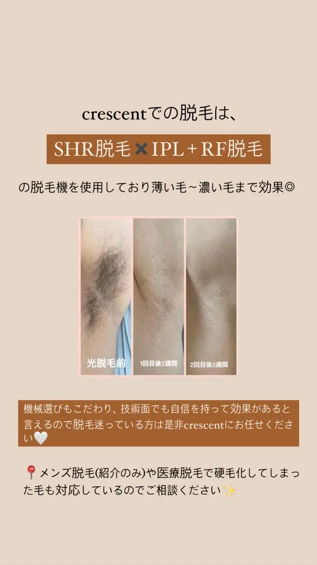 脱毛 【韓国肌管理・脱毛】 クレセントのその他イメージ