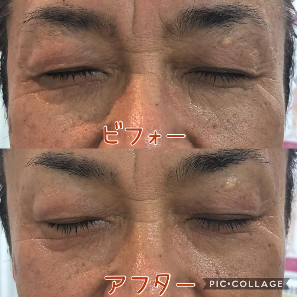 メンズ エステサロン LilyRoseのエステ・リラクイメージ