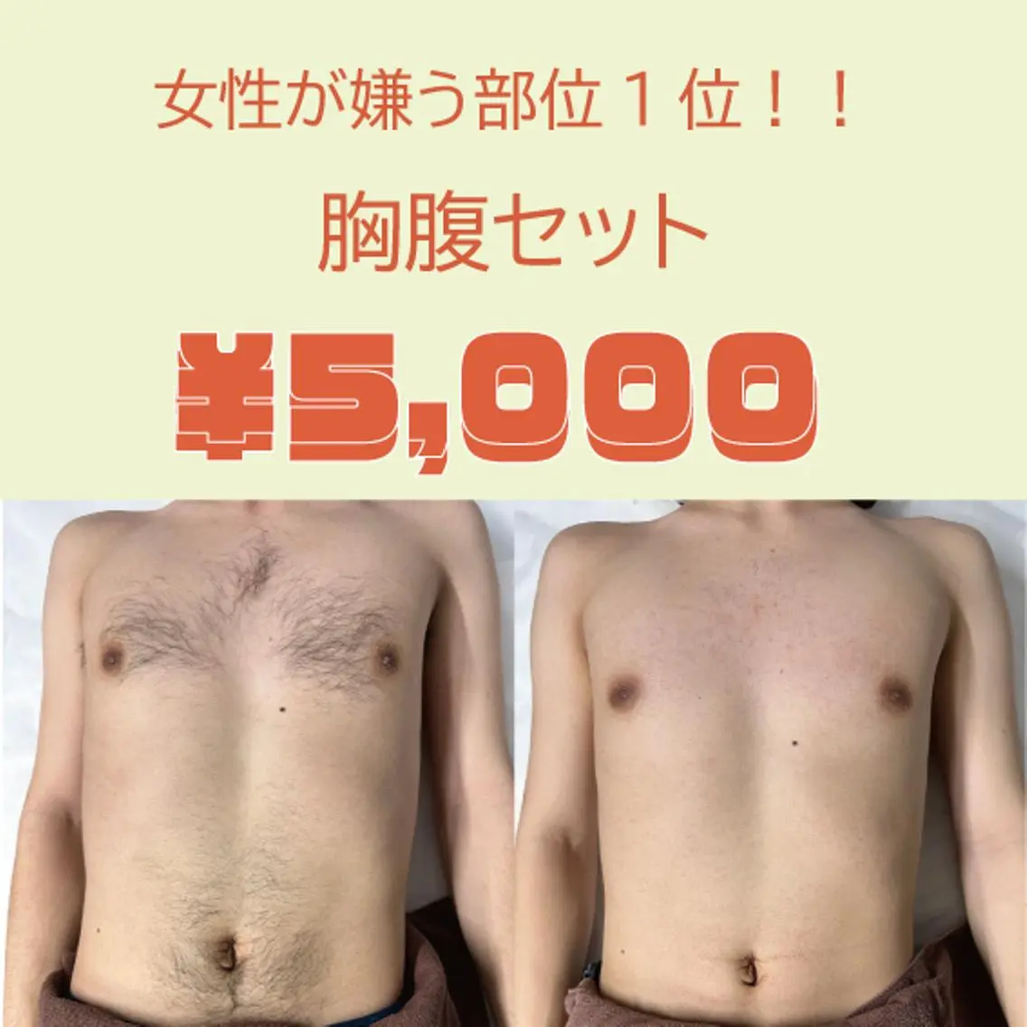 【女性が嫌う部位1位】メンズ　胸・腹セットの写真