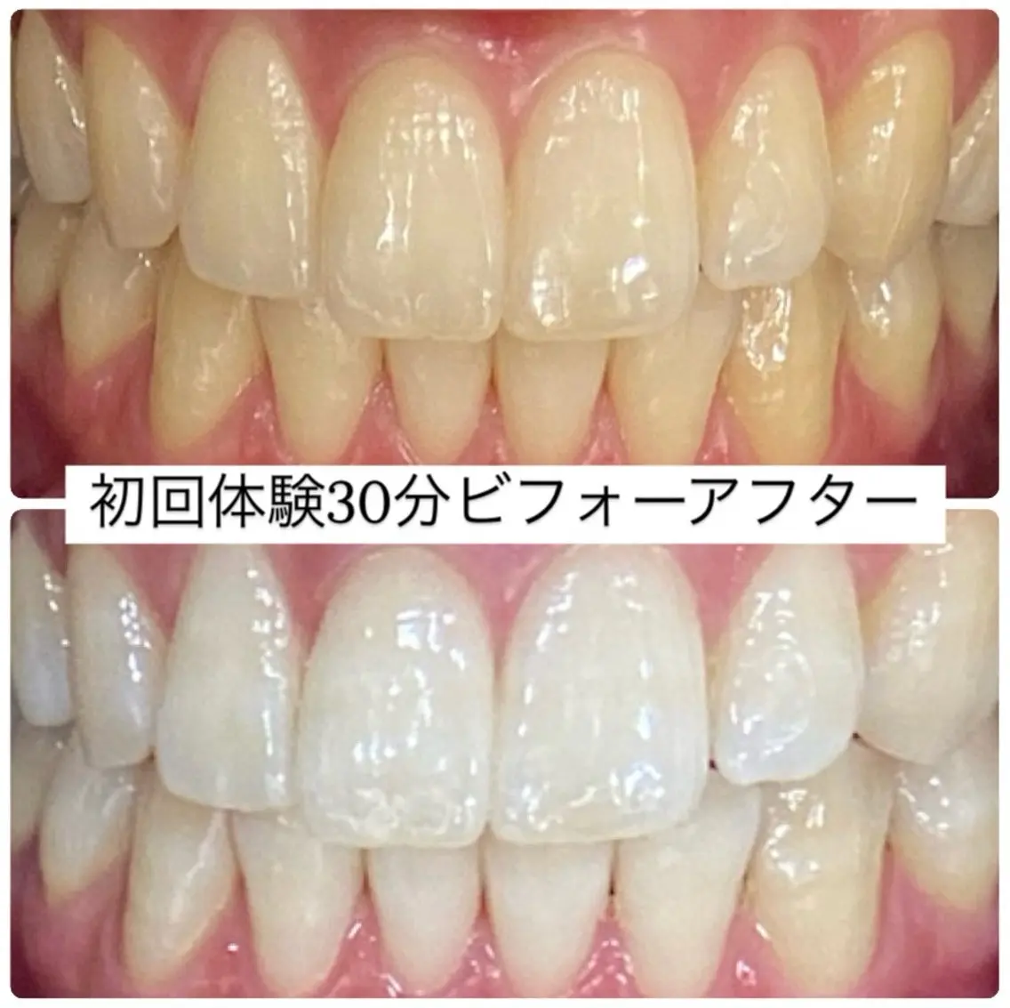 ホワイトニングルーム 横浜店のその他イメージ