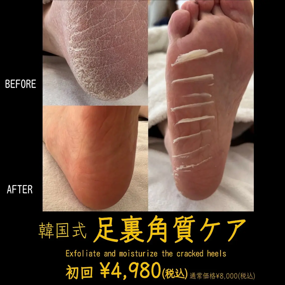 エステサロン LYSH愛名のエステ・リラクイメージ