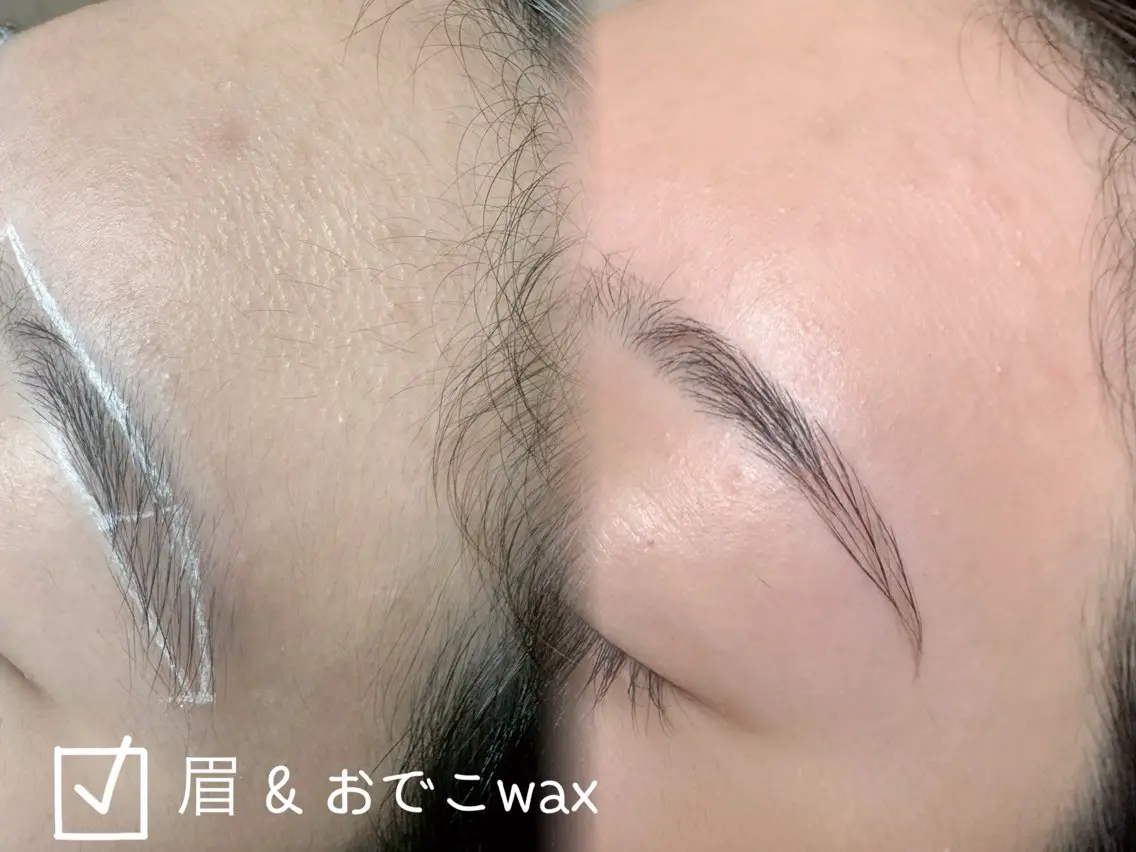 期間限定⚡️おでこ　✖️ 眉毛ワックス【Google口コミ投稿してくれる方】の写真