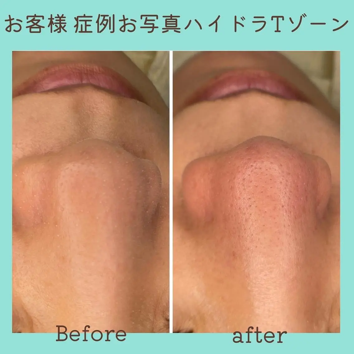 E LINDAのネイルデザイン