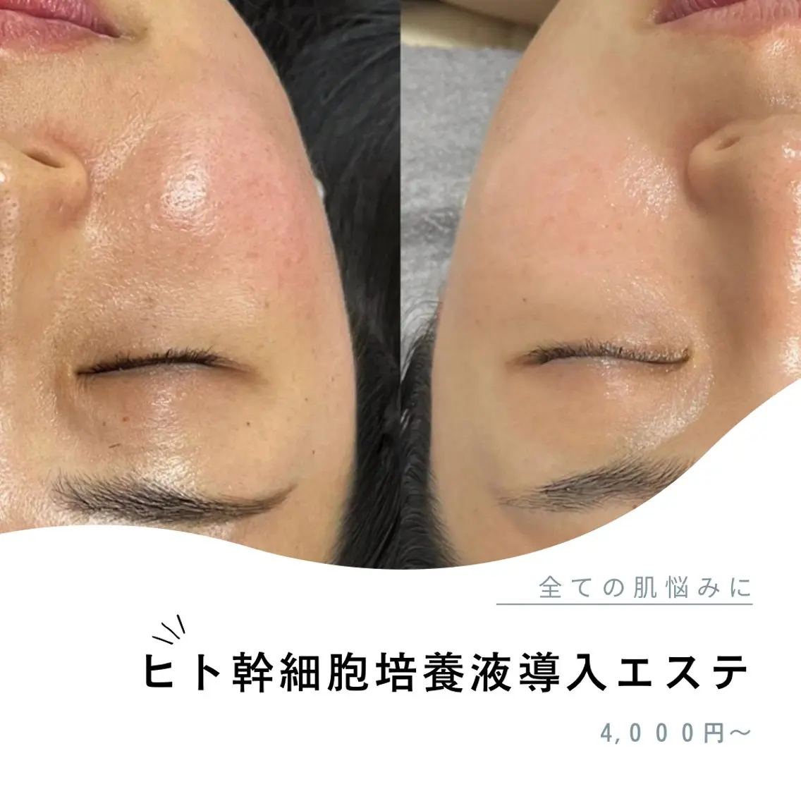 エステ Lyf salon.のエステ・リラクイメージ