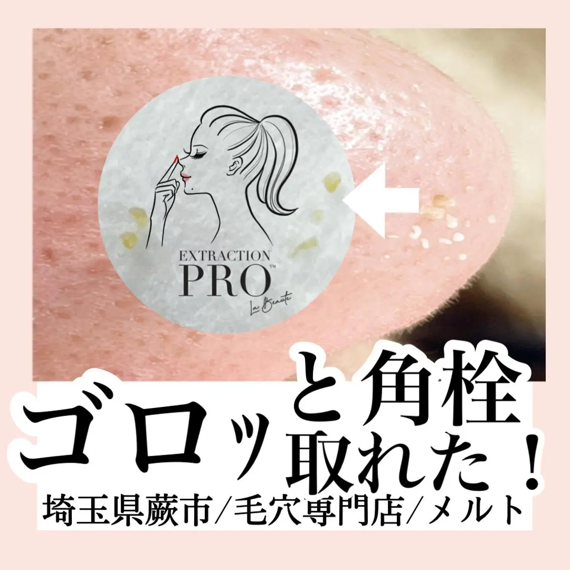 C. Lのマツエク・マツパデザイン