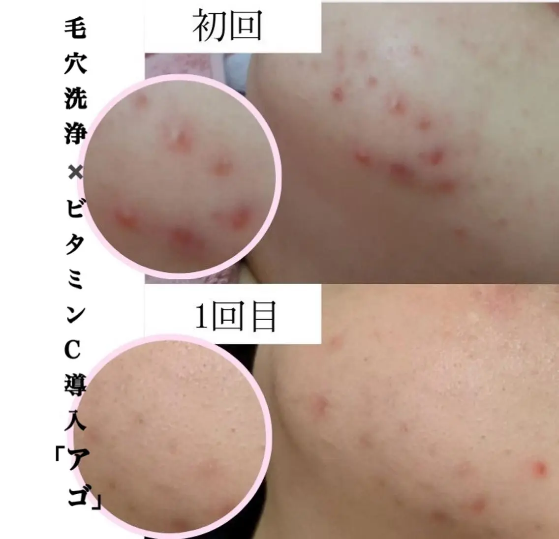 エステ 肌ケア&毛穴洗浄 Cheri/女性専用のエステ・リラクイメージ