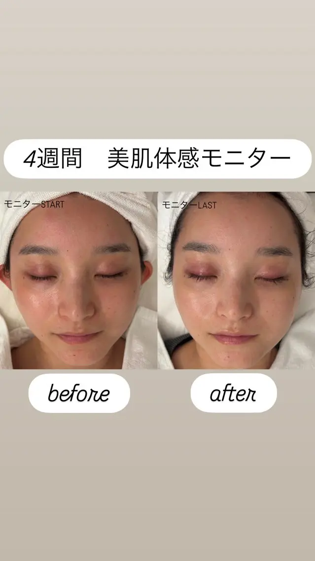 肌育成サロン こまつみなみのエステ・リラクイメージ