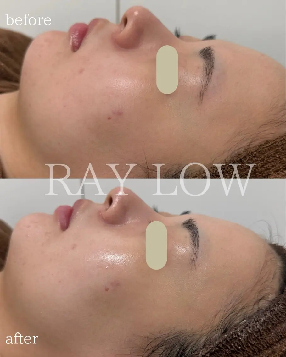 RAY LOW (レイロウ)北浜のエステ・リラクイメージ