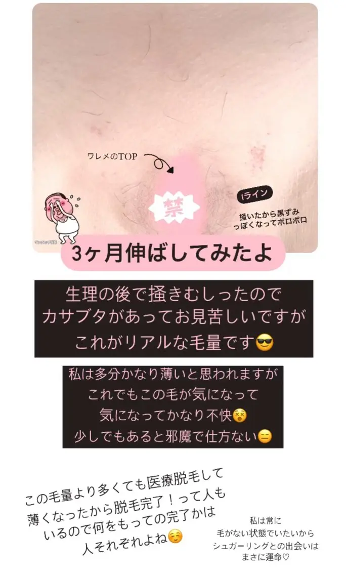 豊橋 ｜Hitomi シュガーリング専門店のエステ・リラクイメージ