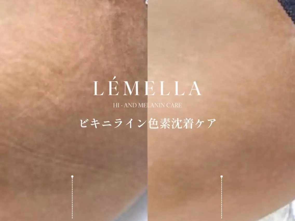 エステ M FLOAT skin salonのエステ・リラクイメージ