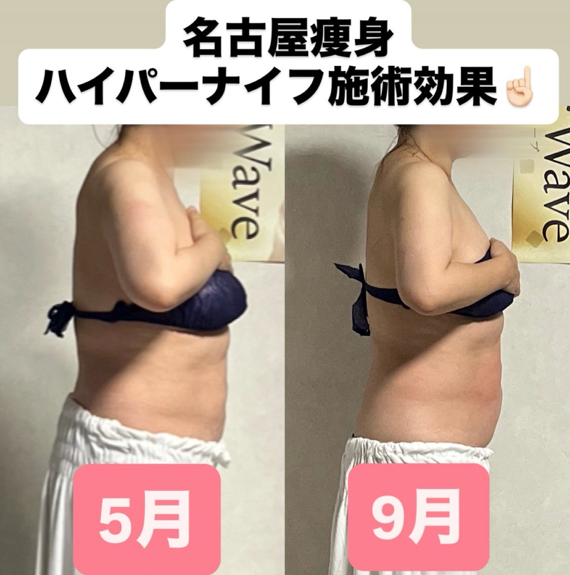 エステ リラク ハイパーナイフ専門 熊田陽子のエステ・リラクイメージ