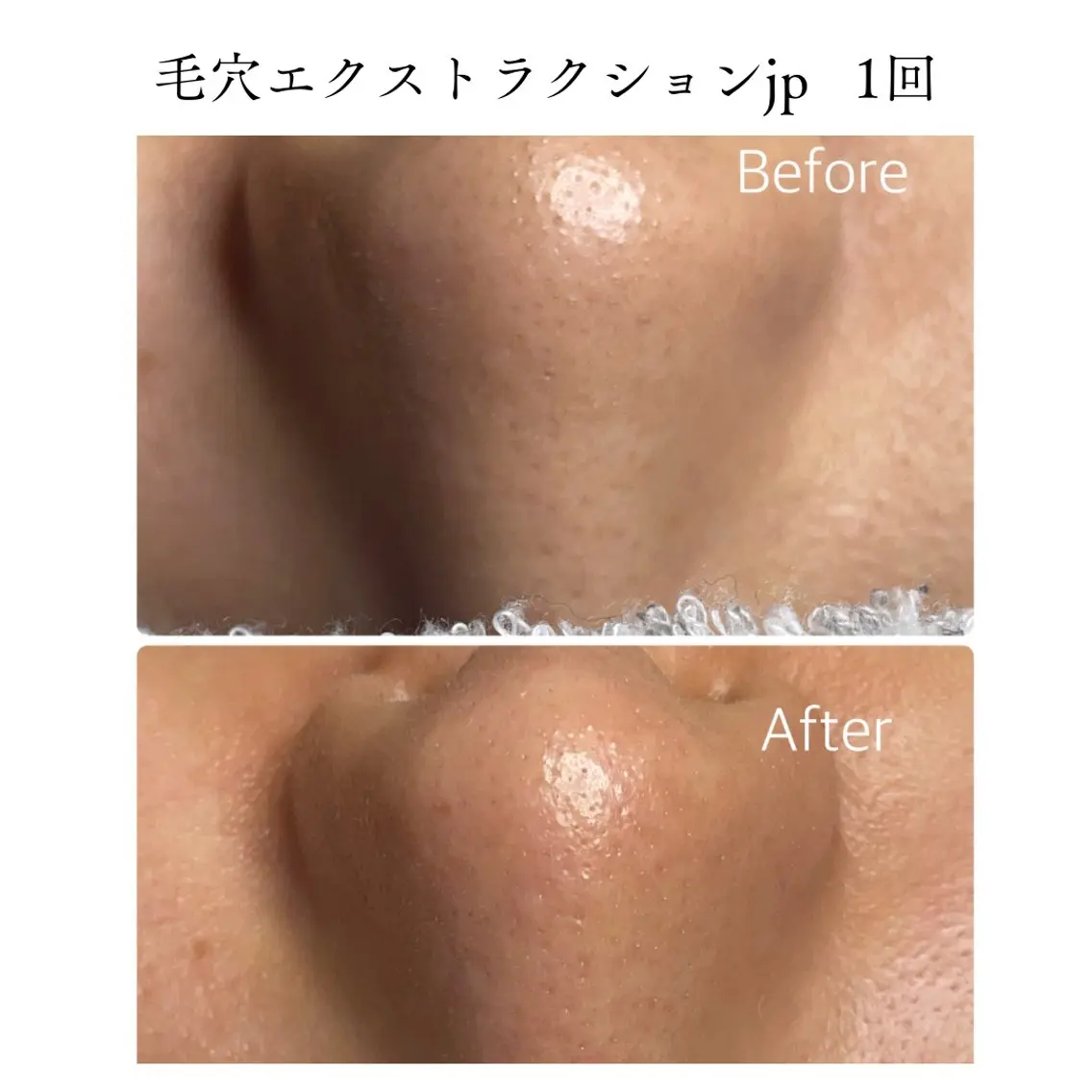 エステ TiALASH Estheticのエステ・リラクイメージ